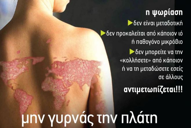 Ενημερωτική δράση στην Τρίπολη – «Η ψωρίαση δεν είναι μεταδοτική!»